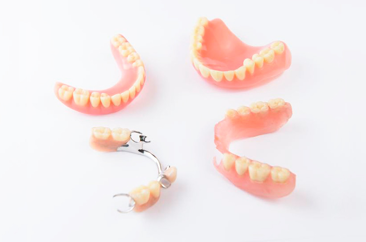 インプラント治療